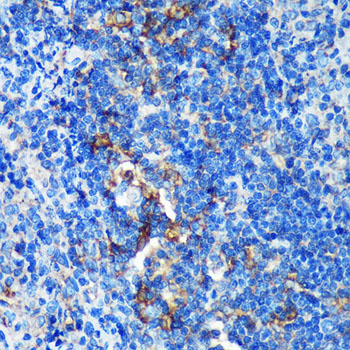 GMIP Rabbit polyclonal antibody
