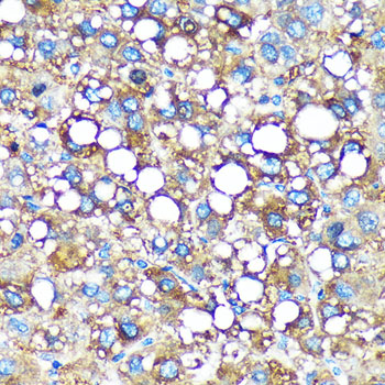 GMIP Rabbit polyclonal antibody