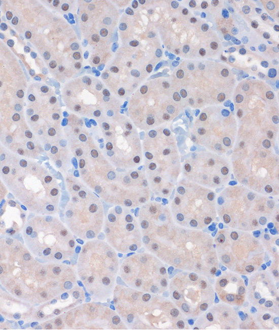 MTMR8 Rabbit polyclonal antibody
