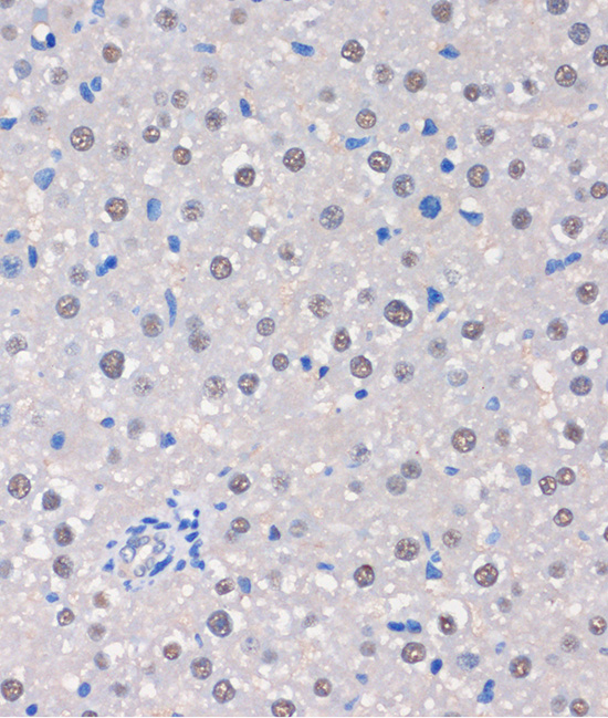 MTMR8 Rabbit polyclonal antibody