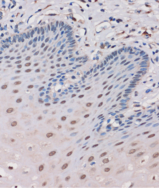 MTMR8 Rabbit polyclonal antibody