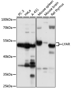 LYAR Rabbit polyclonal antibody