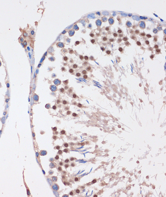 LYAR Rabbit polyclonal antibody
