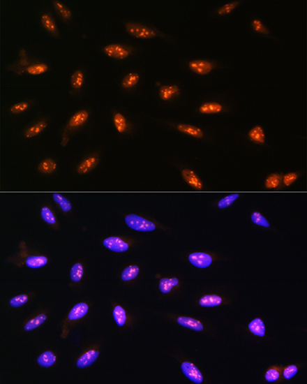 LYAR Rabbit polyclonal antibody