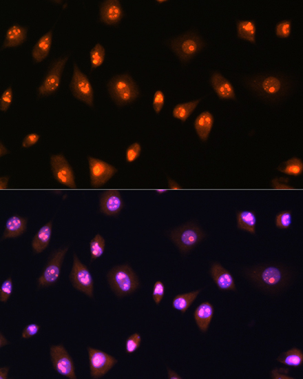 LYAR Rabbit polyclonal antibody