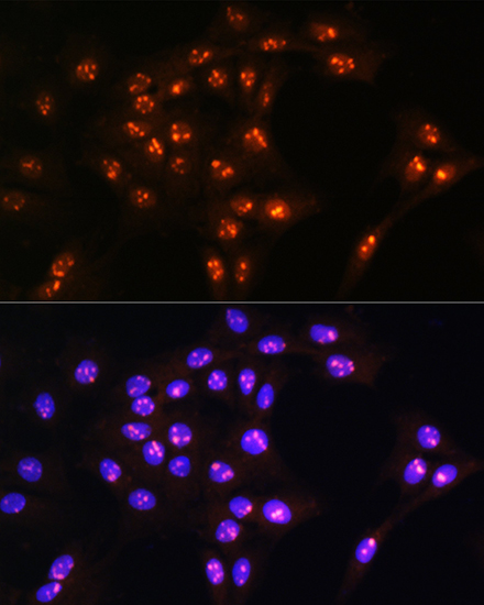 LYAR Rabbit polyclonal antibody