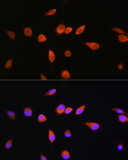 RAB20 Rabbit polyclonal antibody