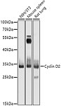 Western blot - Cyclin D2 Rabbit pAb (A1773)