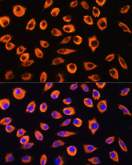 PCDHB4 Rabbit polyclonal antibody