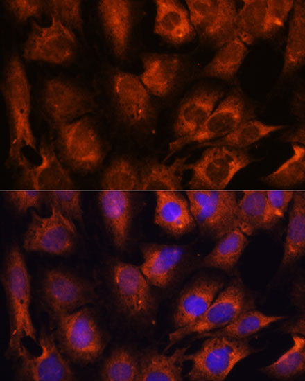 INPP5E Rabbit polyclonal antibody