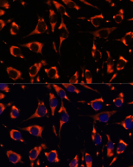 INPP5E Rabbit polyclonal antibody