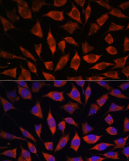 POGLUT1 Rabbit polyclonal antibody
