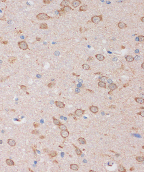 STIM2 Rabbit polyclonal antibody