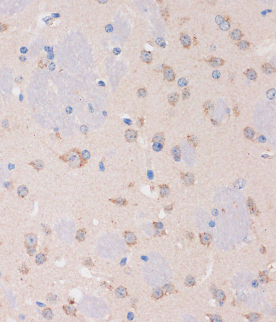 STIM2 Rabbit polyclonal antibody