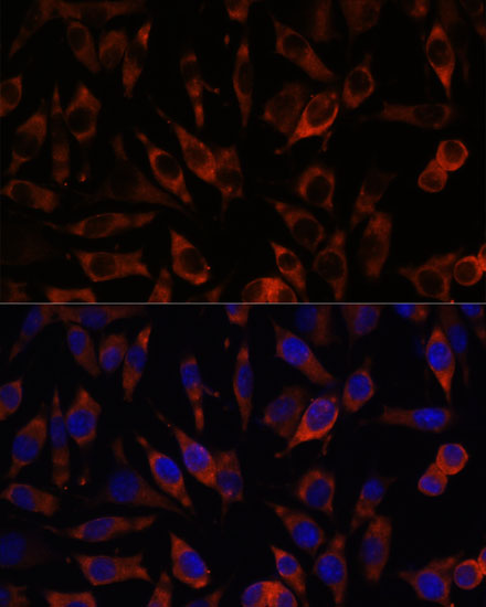 STIM2 Rabbit polyclonal antibody
