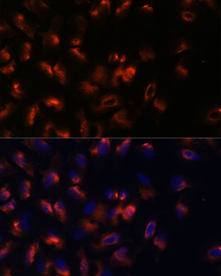 STIM2 Rabbit polyclonal antibody