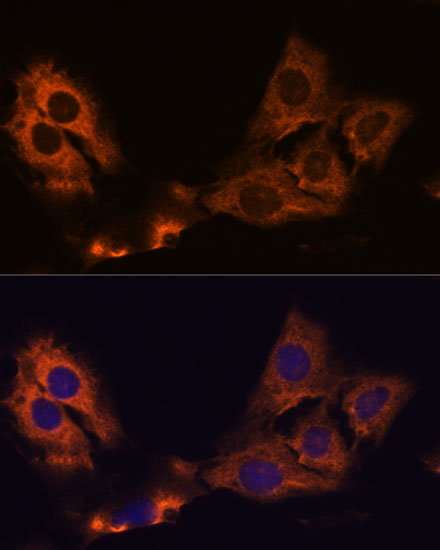SMAP1 Rabbit polyclonal antibody