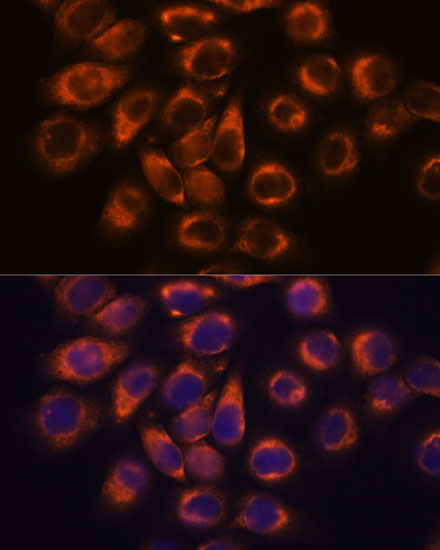 SMAP1 Rabbit polyclonal antibody