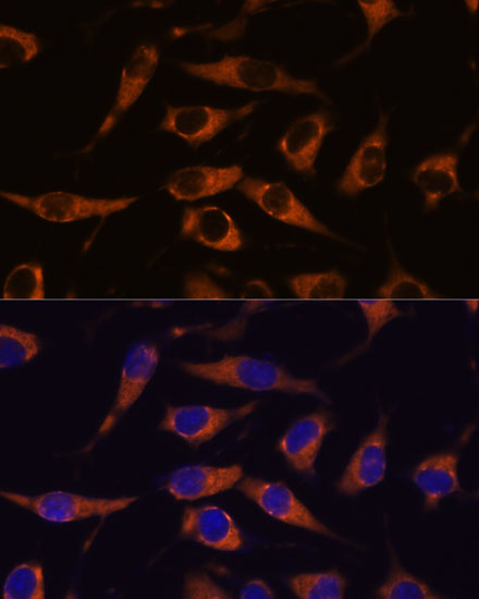 SMAP1 Rabbit polyclonal antibody