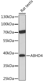 ABHD4 Rabbit polyclonal antibody