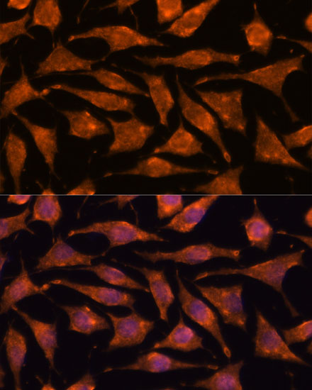 ABHD4 Rabbit polyclonal antibody