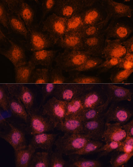 CHTF18 Rabbit polyclonal antibody