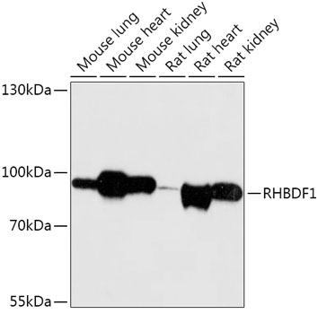 RHBDF1 Rabbit polyclonal antibody