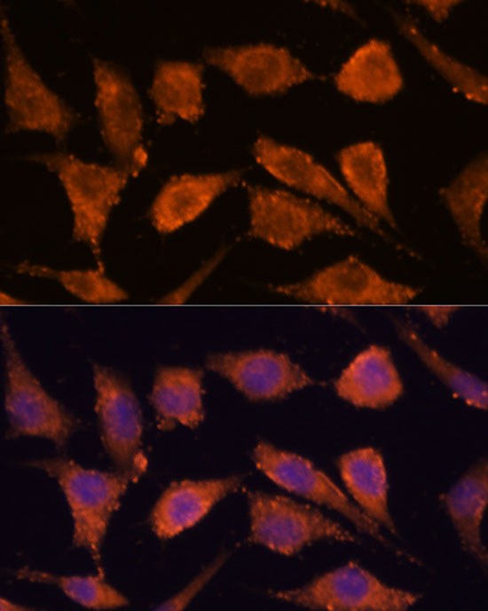 RHBDF1 Rabbit polyclonal antibody