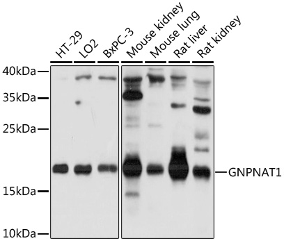 GNPNAT1 Rabbit polyclonal antibody