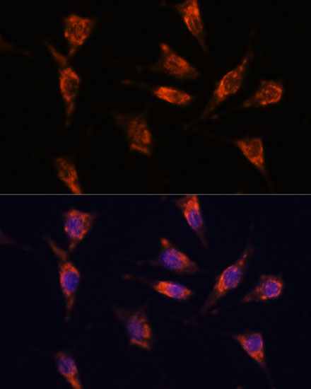 GNPNAT1 Rabbit polyclonal antibody