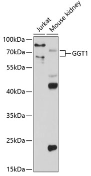 GGT1 Rabbit polyclonal antibody