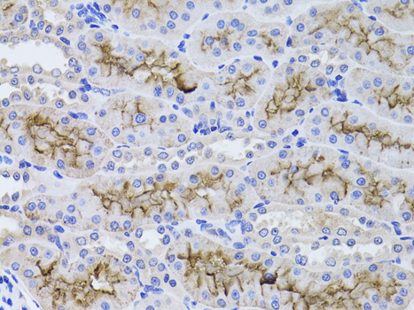 GGT1 Rabbit polyclonal antibody