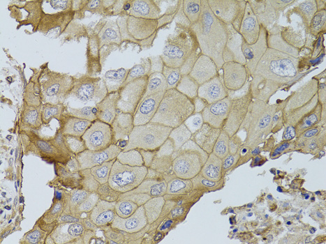 GGT1 Rabbit polyclonal antibody