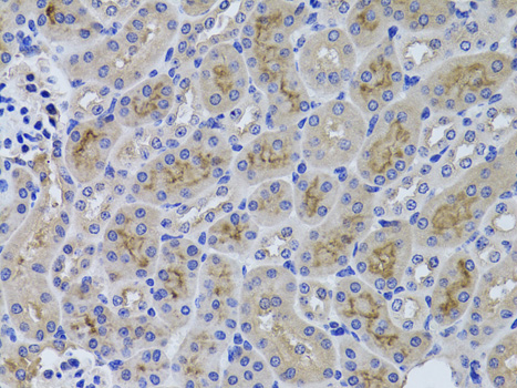GGT1 Rabbit polyclonal antibody