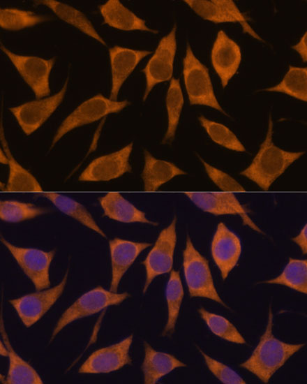 MRPL34 Rabbit polyclonal antibody