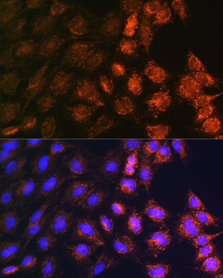 [KO Validated] SLC25A22 Rabbit polyclonal antibody