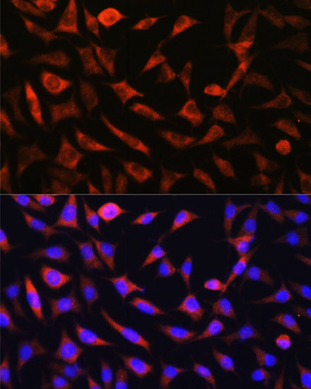 [KO Validated] SLC25A22 Rabbit polyclonal antibody