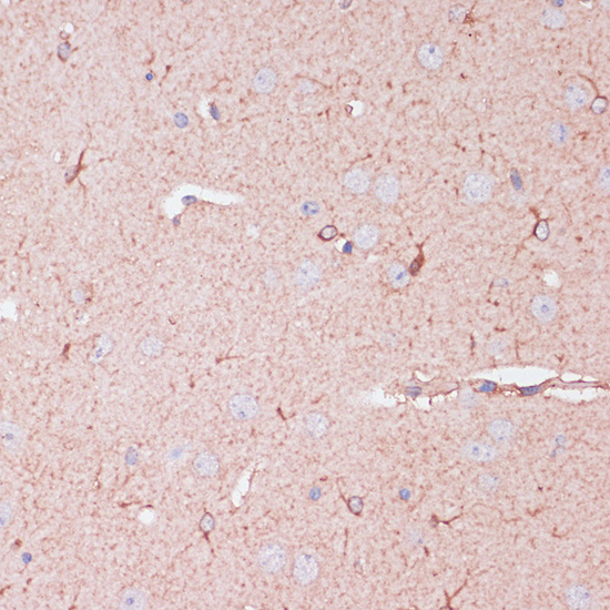 CD82 Rabbit polyclonal antibody