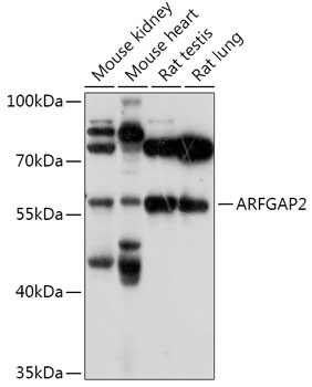 ARFGAP2 Rabbit polyclonal antibody