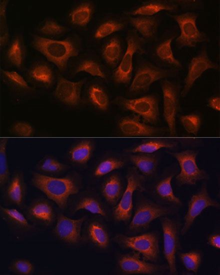ARFGAP2 Rabbit polyclonal antibody