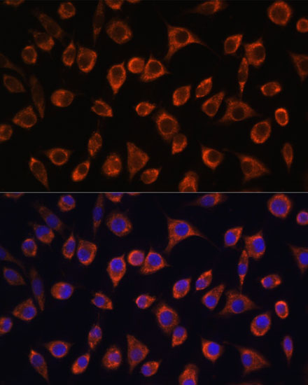 MRPL43 Rabbit polyclonal antibody