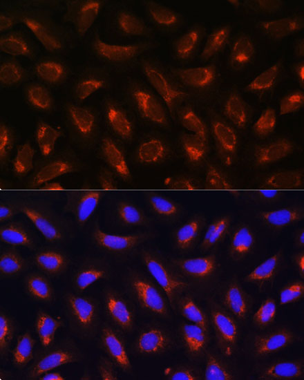 MRPL43 Rabbit polyclonal antibody