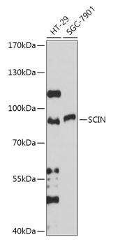 SCIN Rabbit polyclonal antibody