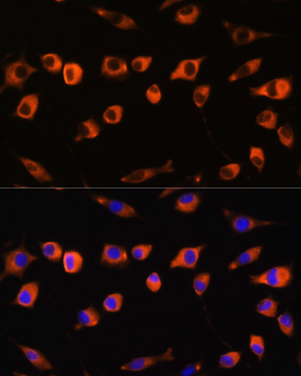 SCIN Rabbit polyclonal antibody