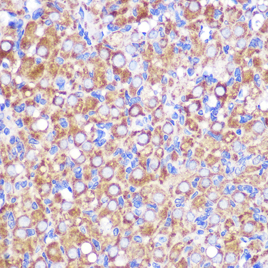 NEK9 Rabbit polyclonal antibody
