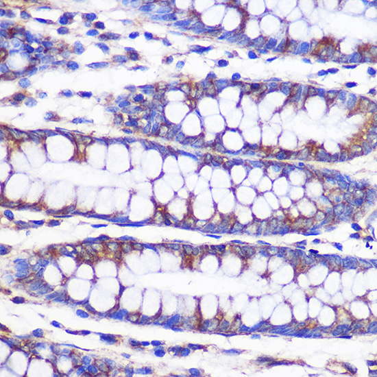 NEK9 Rabbit polyclonal antibody
