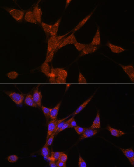 AKR1C3 Rabbit polyclonal antibody