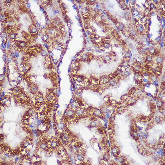 PIGM Rabbit polyclonal antibody