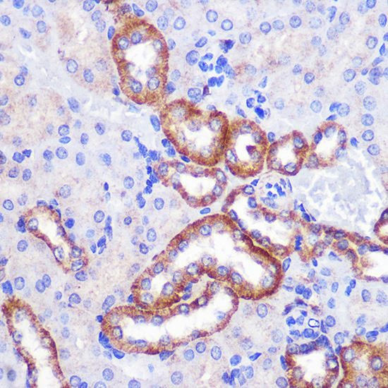PIGM Rabbit polyclonal antibody
