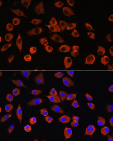 PIGM Rabbit polyclonal antibody